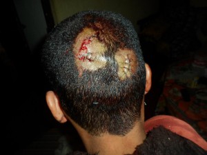 1555766_10202758196376975_363774310_n