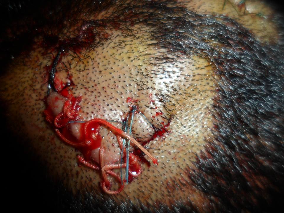 اعتداء على شاب قرب السوق الأسبوعي لمدينة أزمور – بالصور –