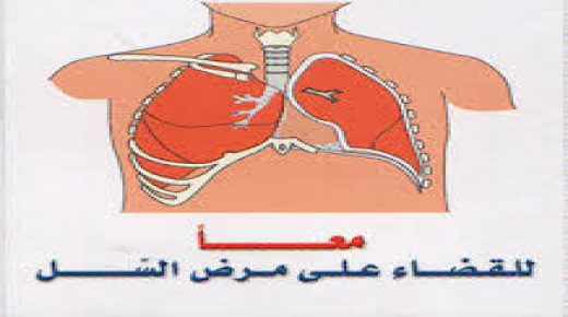 بلاغ صحفي : تخليد اليوم العالمي لمحاربة داء السل تحت شعار” الوقت يداهمنا”